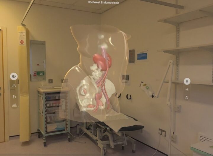 UK hospital uses Apple Vision Pro to help patients visualize surgeries